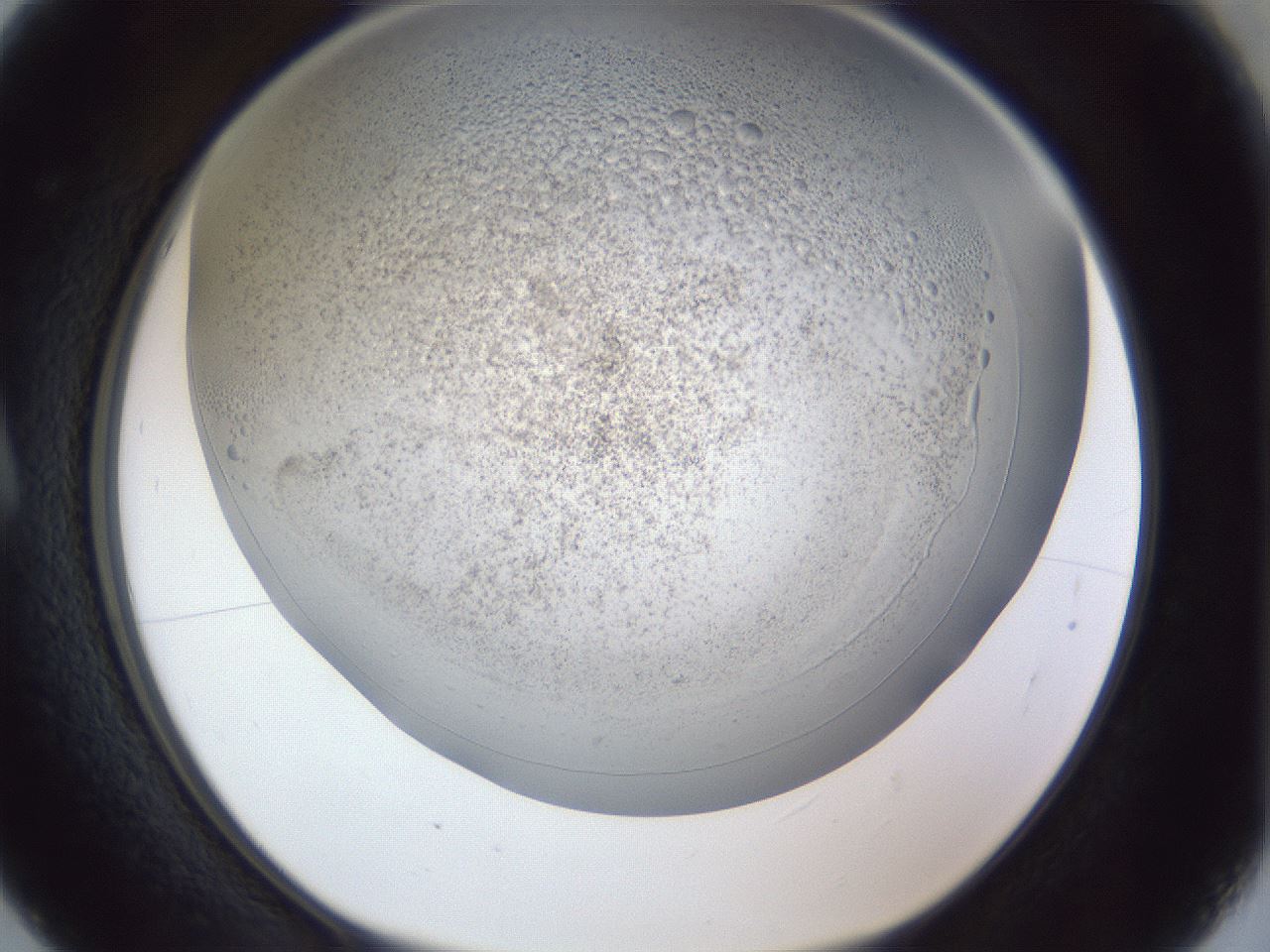 folderID966_plateID966_batchID1372_wellNum5_profileID1_d1_r37666_ef.jpg