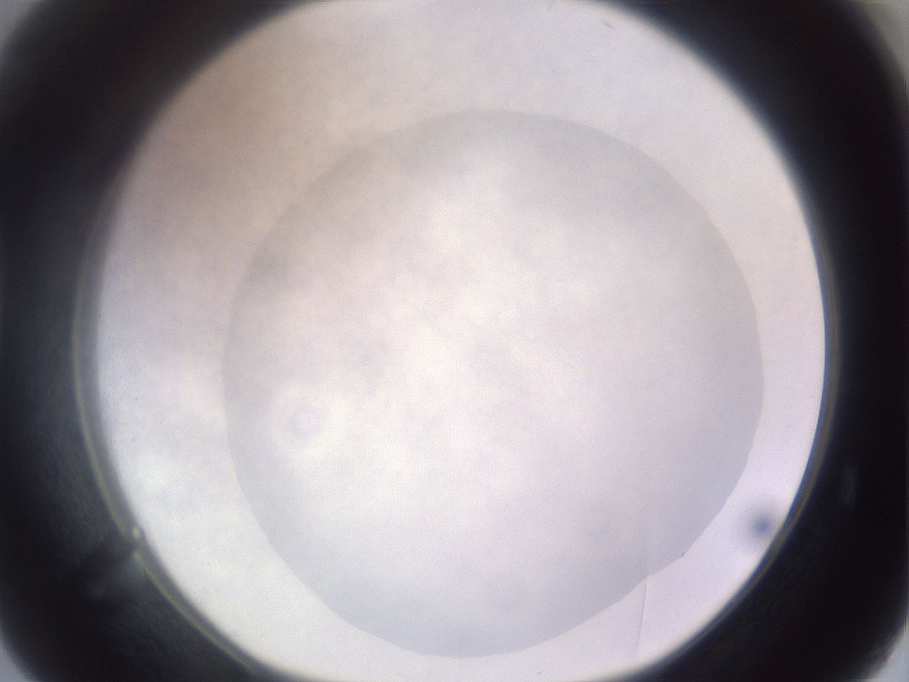 folderID971_plateID1971_batchID8610_wellNum38_profileID1_d1_r133024_ef.jpg