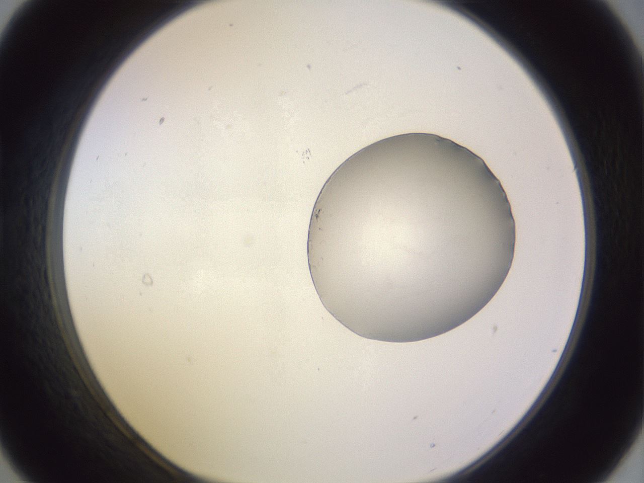 folderID972_plateID1972_batchID8604_wellNum21_profileID1_d1_r131838_ef.jpg