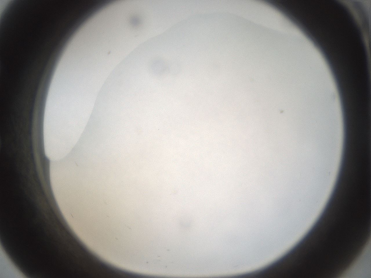folderID975_plateID1975_batchID8607_wellNum57_profileID1_d1_r132486_ef.jpg