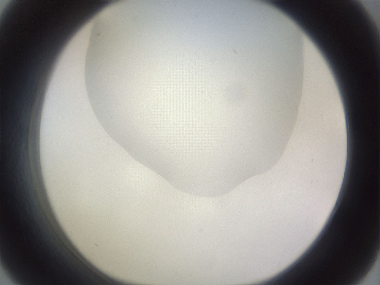 folderID979_plateID1979_batchID8606_wellNum33_profileID1_d1_r132246_ef.jpg