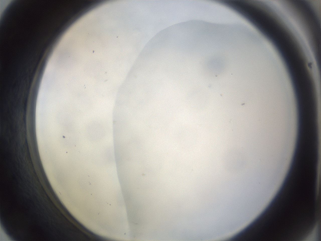 folderID979_plateID1979_batchID8606_wellNum57_profileID1_d1_r132294_ef.jpg