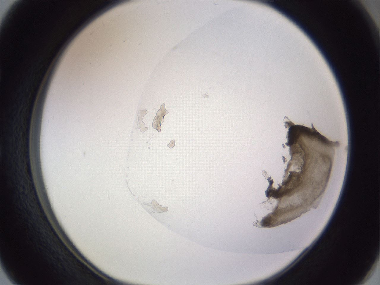 folderID981_plateID1981_batchID8595_wellNum50_profileID1_d1_r130168_ef.jpg