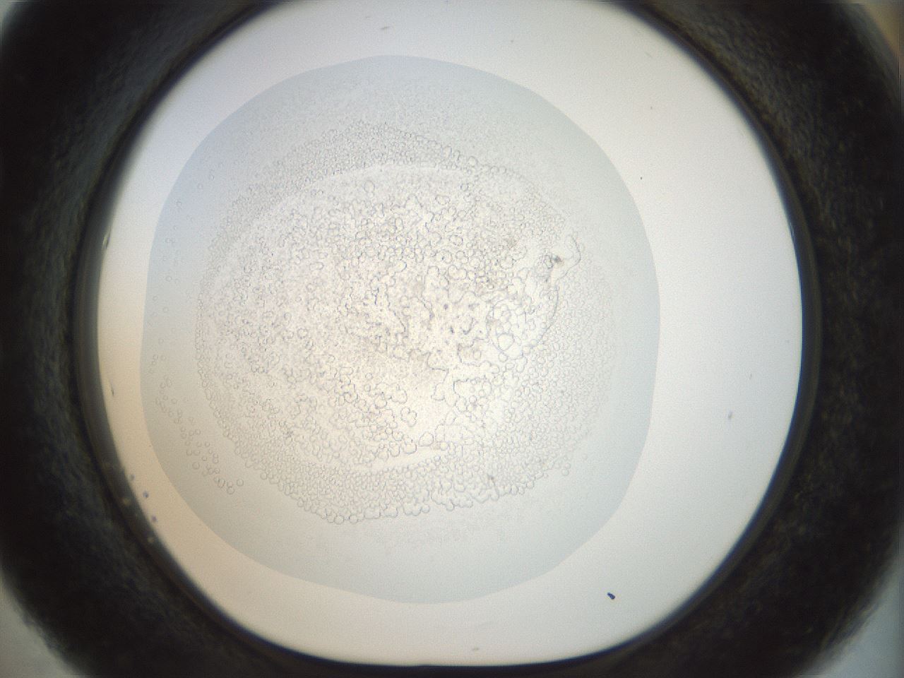 folderID984_plateID984_batchID1494_wellNum53_profileID1_d1_r40226_ef.jpg
