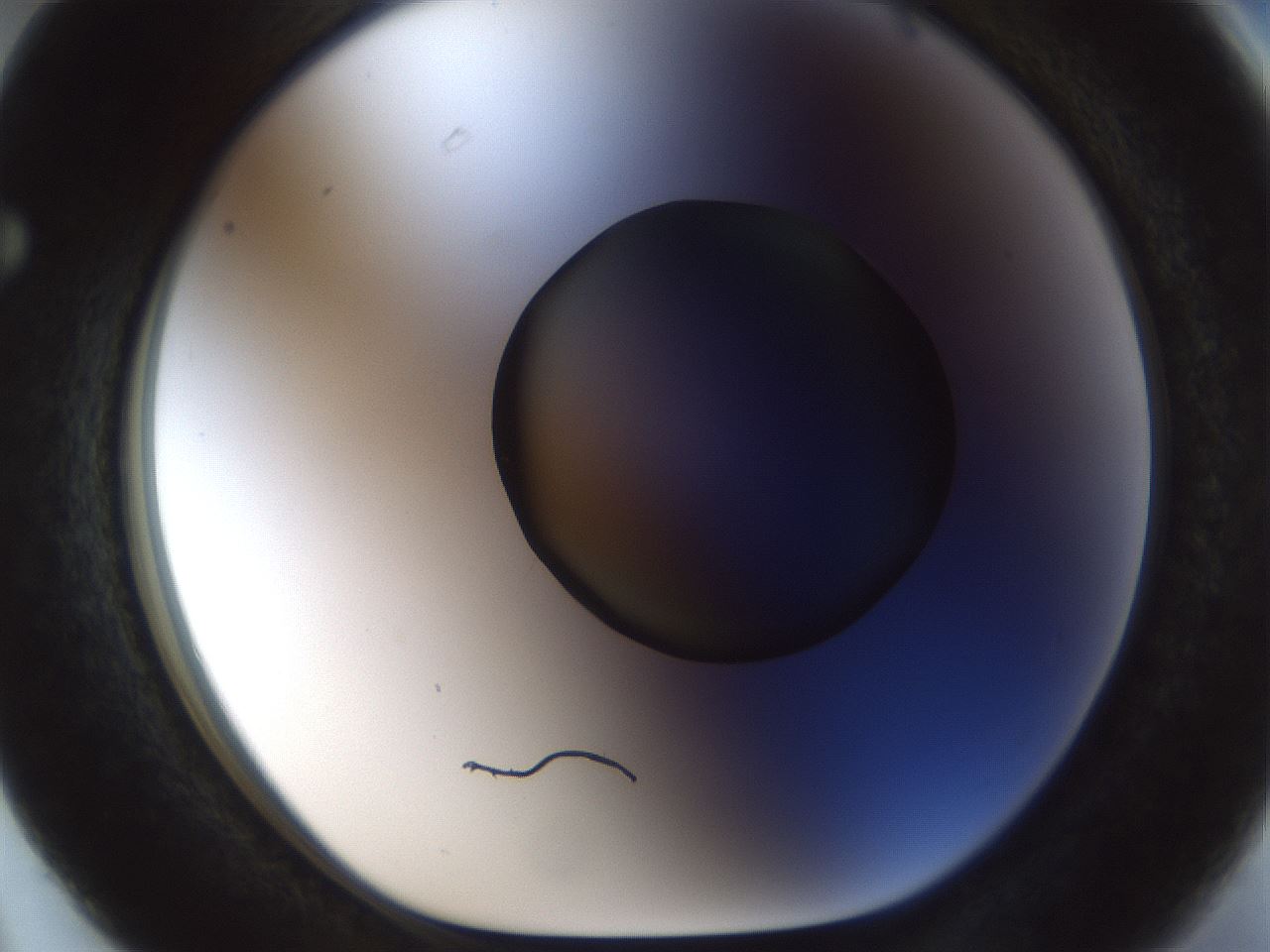folderID985_plateID985_batchID1416_wellNum63_profileID1_d1_r40054_ef.jpg