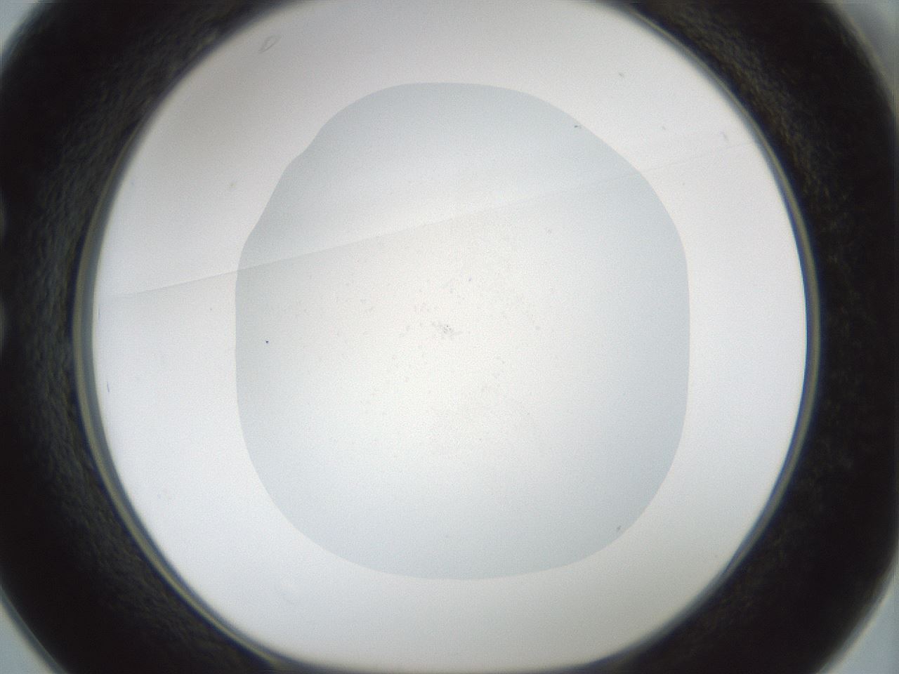 folderID987_plateID987_batchID1639_wellNum25_profileID1_d1_r40362_ef.jpg