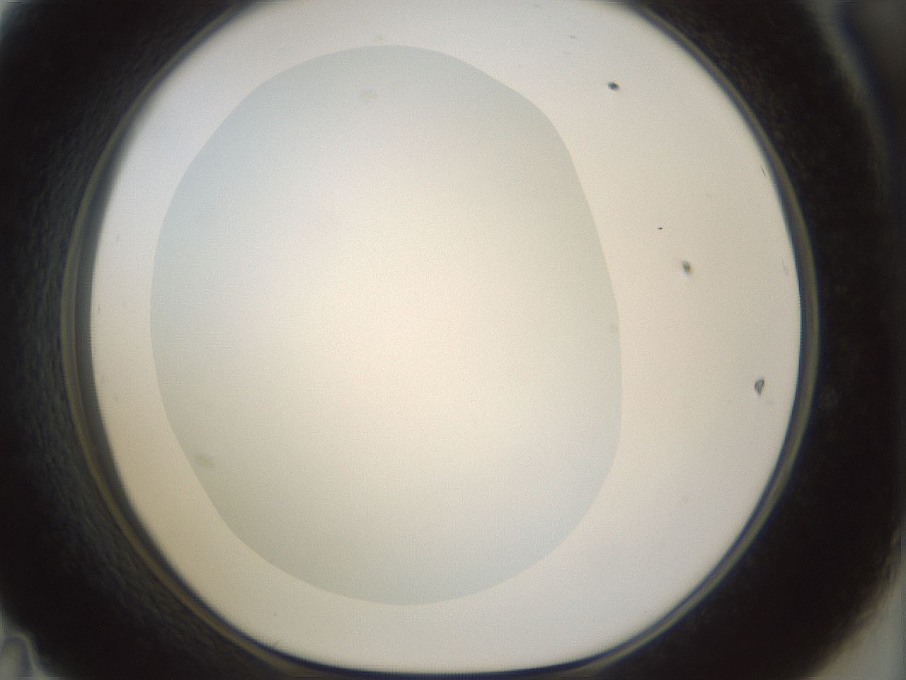 folderID987_plateID987_batchID1639_wellNum47_profileID1_d1_r40406_ef.jpg