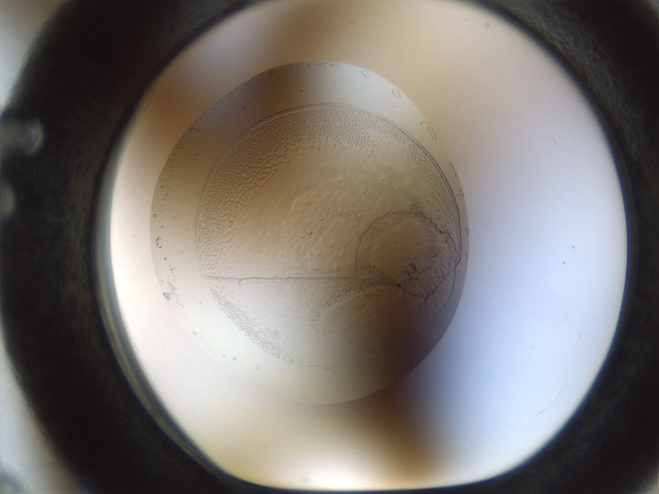 folderID990_plateID990_batchID1630_wellNum63_profileID1_d1_r39094_ef.jpg