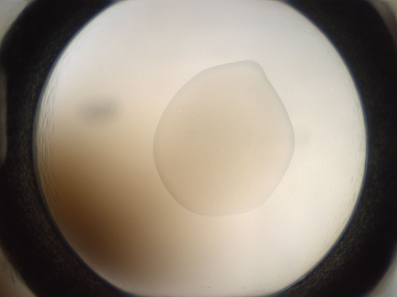 folderID991_plateID1991_batchID8618_wellNum85_profileID1_d1_r134570_ef.jpg