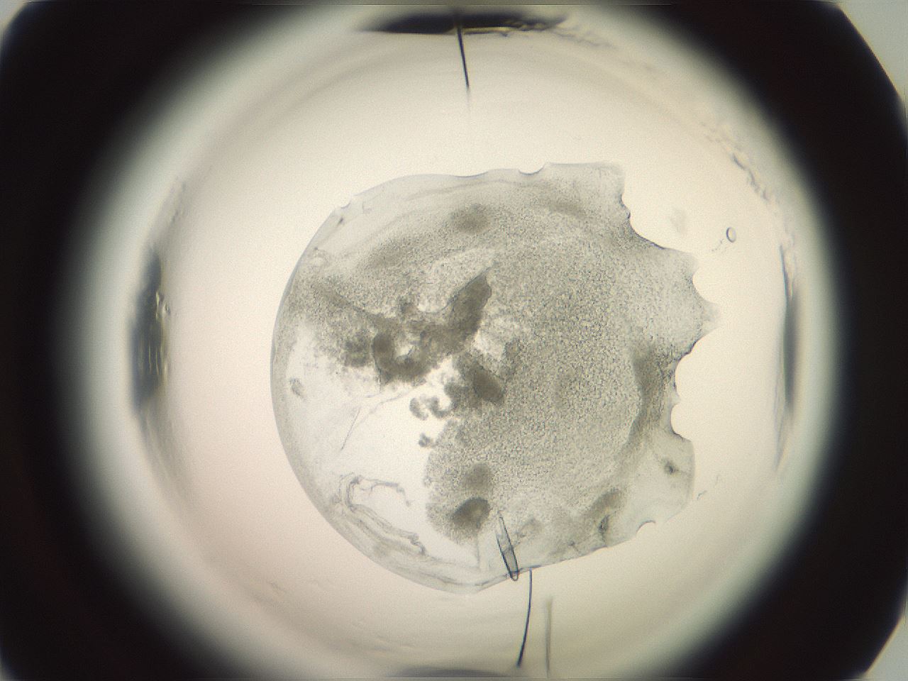 folderID576_plateID2576_batchID14302_wellNum52_profileID1_d2_r197731_ef.jpg