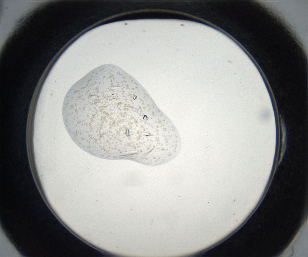 folderID63_plateID2063_batchID9262_wellNum54_profileID1_d2_r142377_ef.jpg