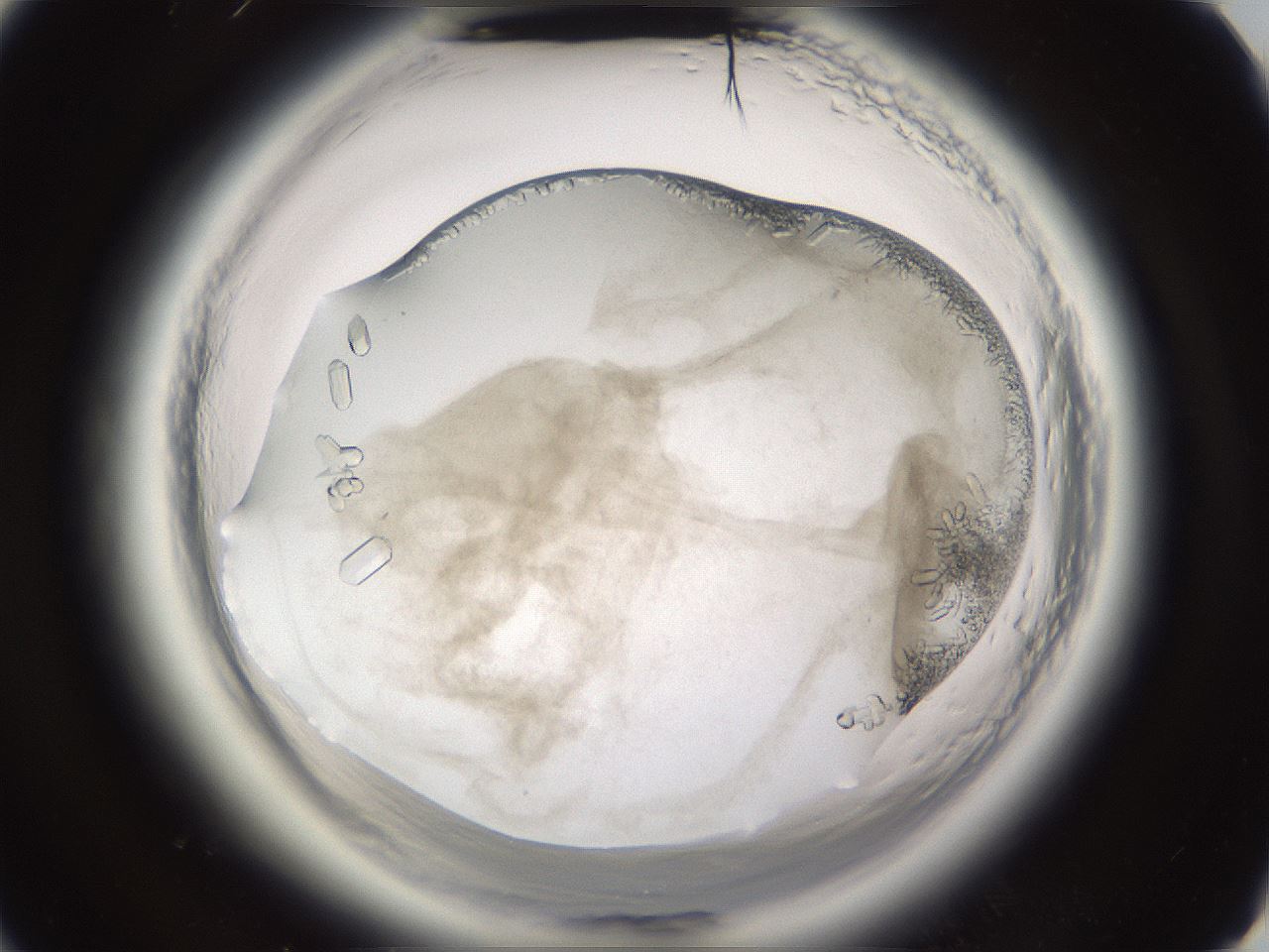 folderID661_plateID1661_batchID6933_wellNum52_profileID1_d3_r110539_ef.jpg