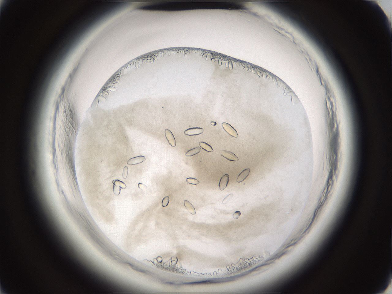 folderID661_plateID1661_batchID6941_wellNum50_profileID1_d2_r110532_ef.jpg