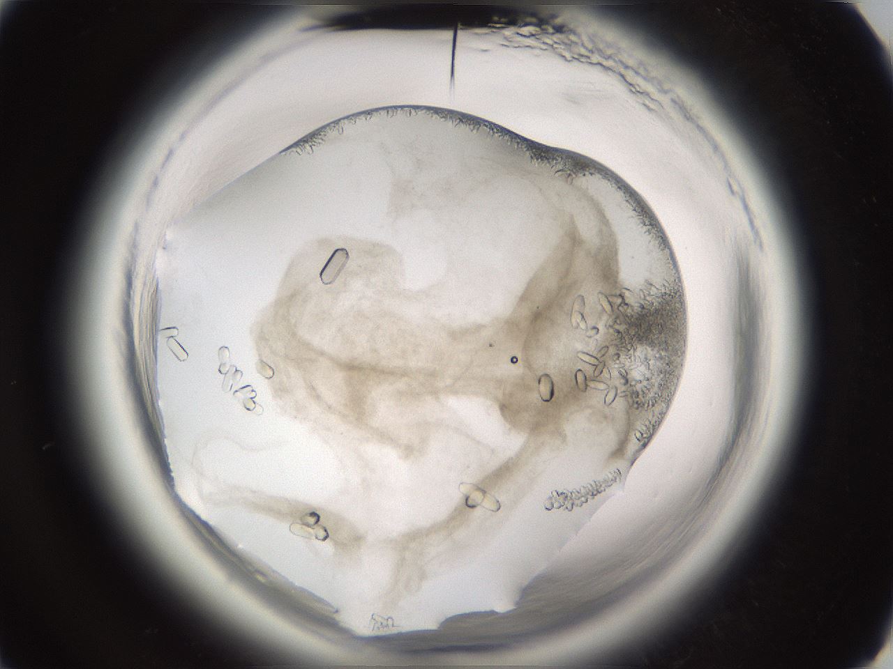 folderID661_plateID1661_batchID6933_wellNum28_profileID1_d3_r110485_ef.jpg