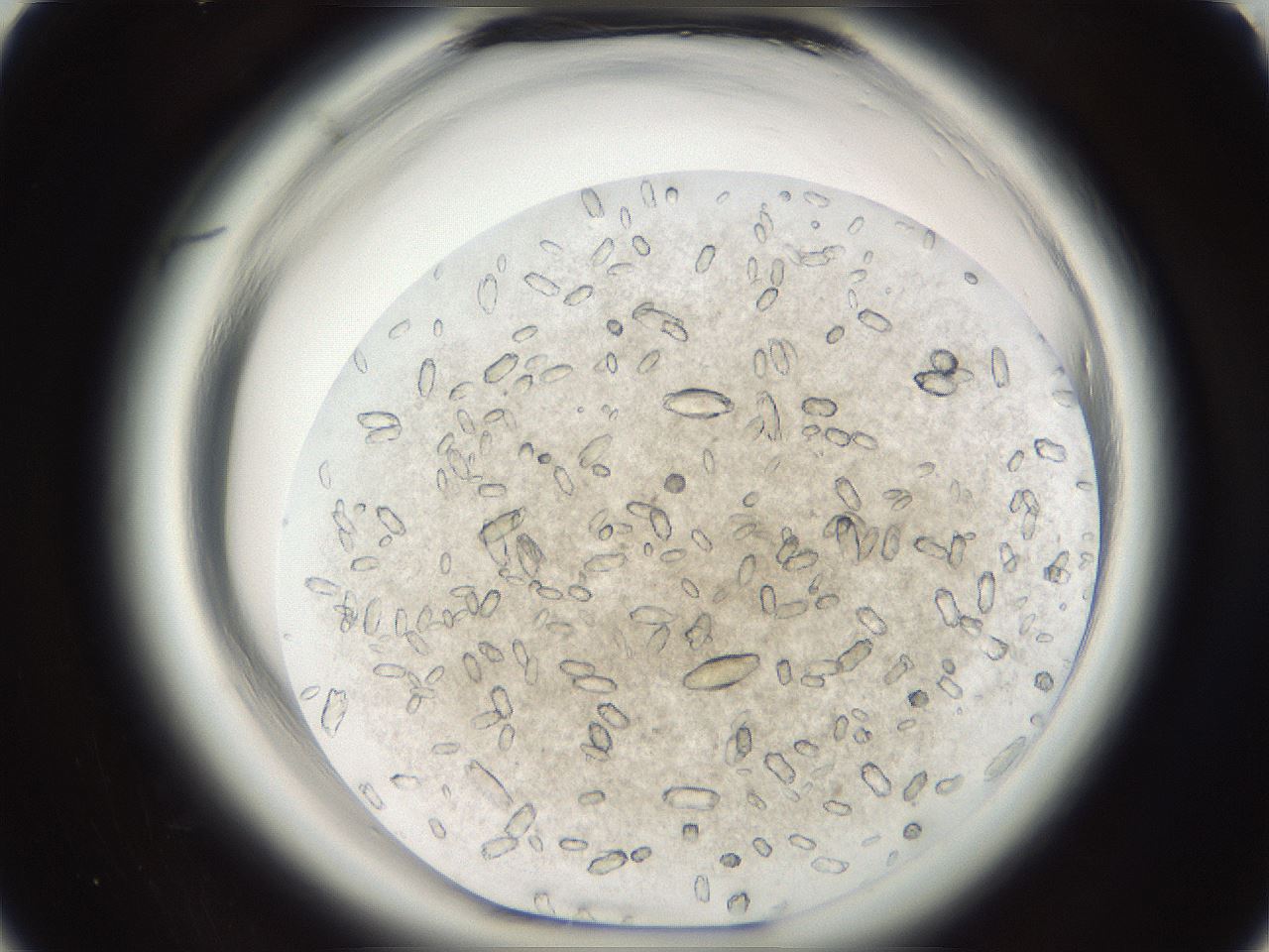 folderID699_plateID1699_batchID7058_wellNum10_profileID1_d1_r112982_ef.jpg
