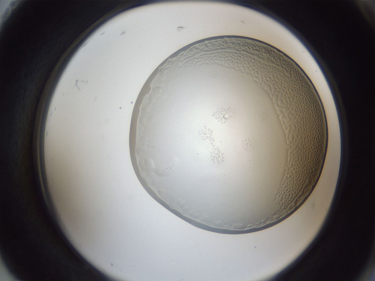folderID165_plateID1165_batchID2920_wellNum92_profileID1_d2_r61270_ef.jpg