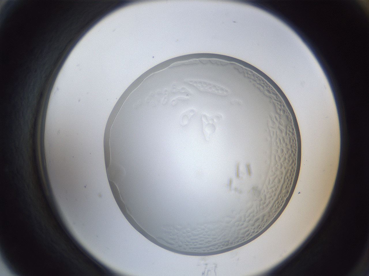 folderID165_plateID1165_batchID3001_wellNum79_profileID1_d2_r61244_ef.jpg