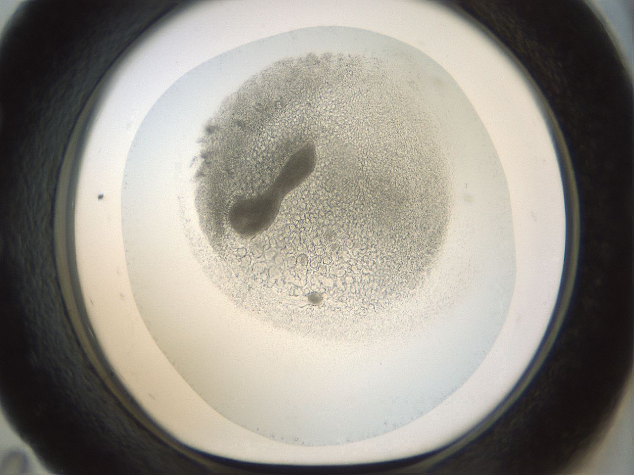 folderID207_plateID1207_batchID3380_wellNum59_profileID1_d1_r67732_ef.jpg