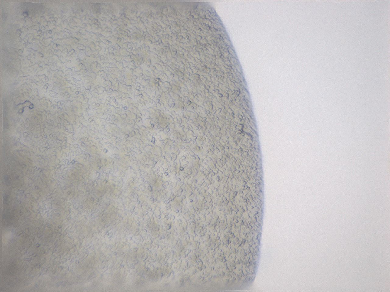 folderID20_plateID3020_batchID16541_wellNum5_profileID1_d1_r252556_ef.jpg