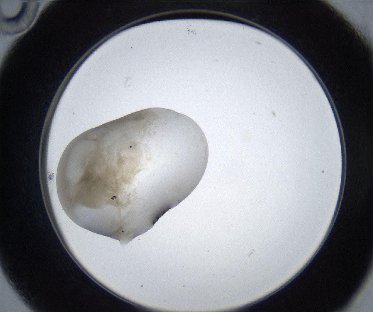 folderID316_plateID3316_batchID19789_wellNum22_profileID1_d2_r292057_ef.jpg