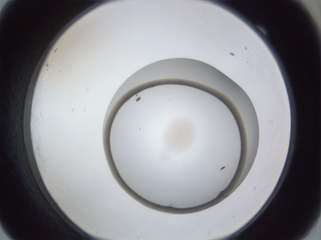 folderID31_plateID1031_batchID2458_wellNum69_profileID1_d1_r44460_ef.jpg