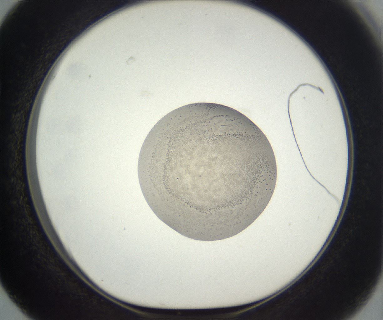 folderID381_plateID3381_batchID19953_wellNum63_profileID1_d1_r299249_ef.jpg