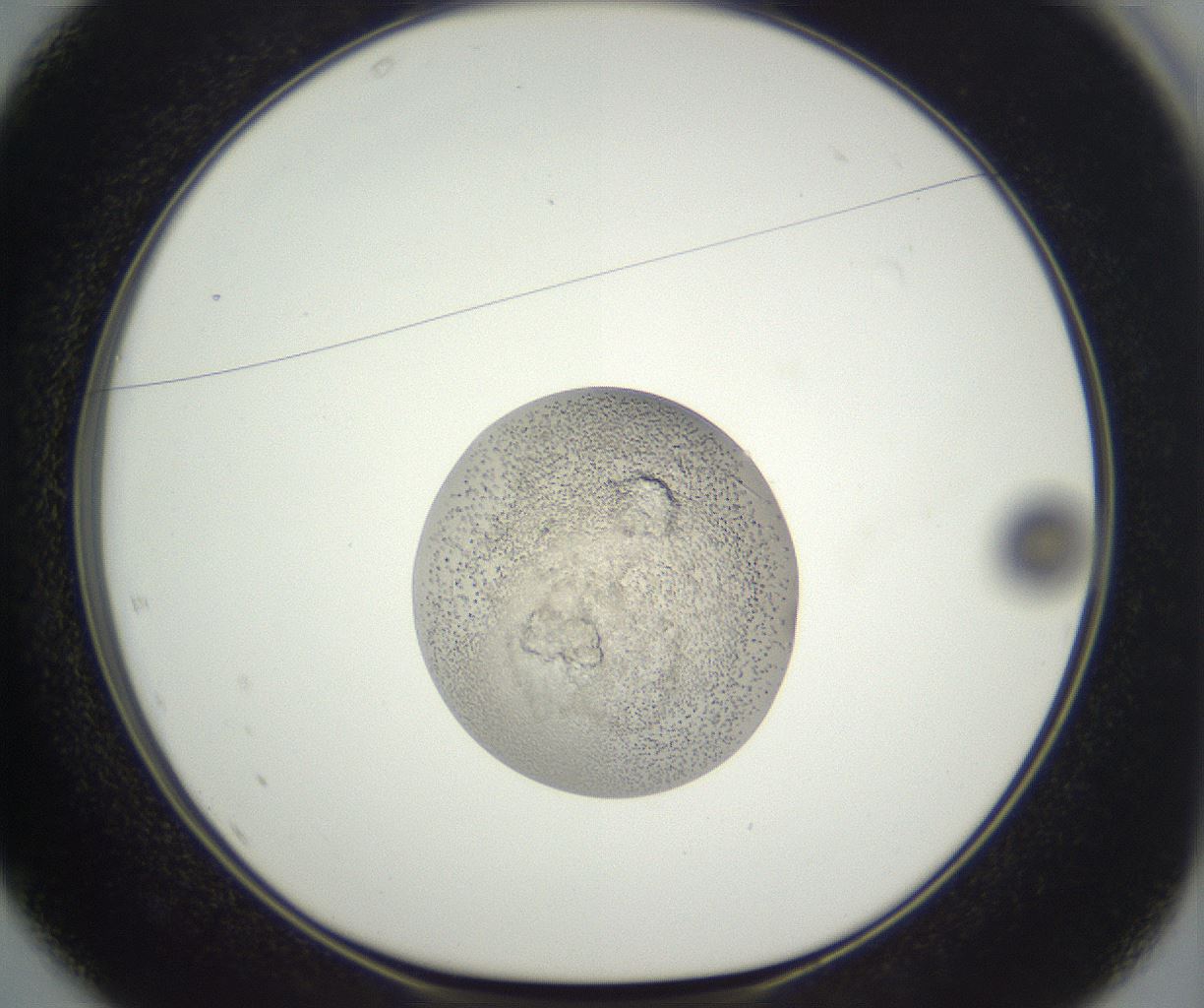 folderID397_plateID3397_batchID19848_wellNum37_profileID1_d1_r301623_ef.jpg