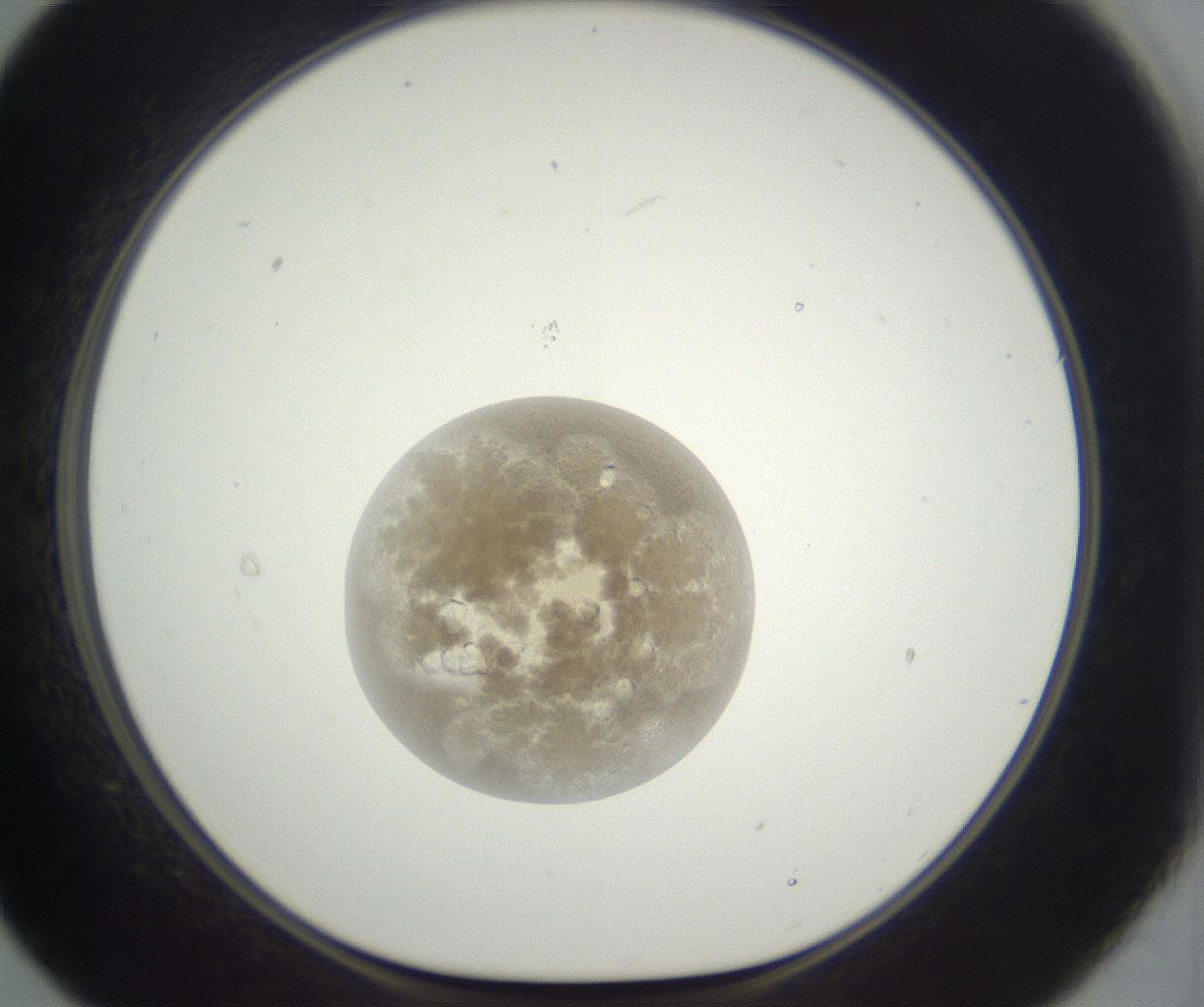 folderID397_plateID3397_batchID19848_wellNum21_profileID1_d1_r301607_ef.jpg