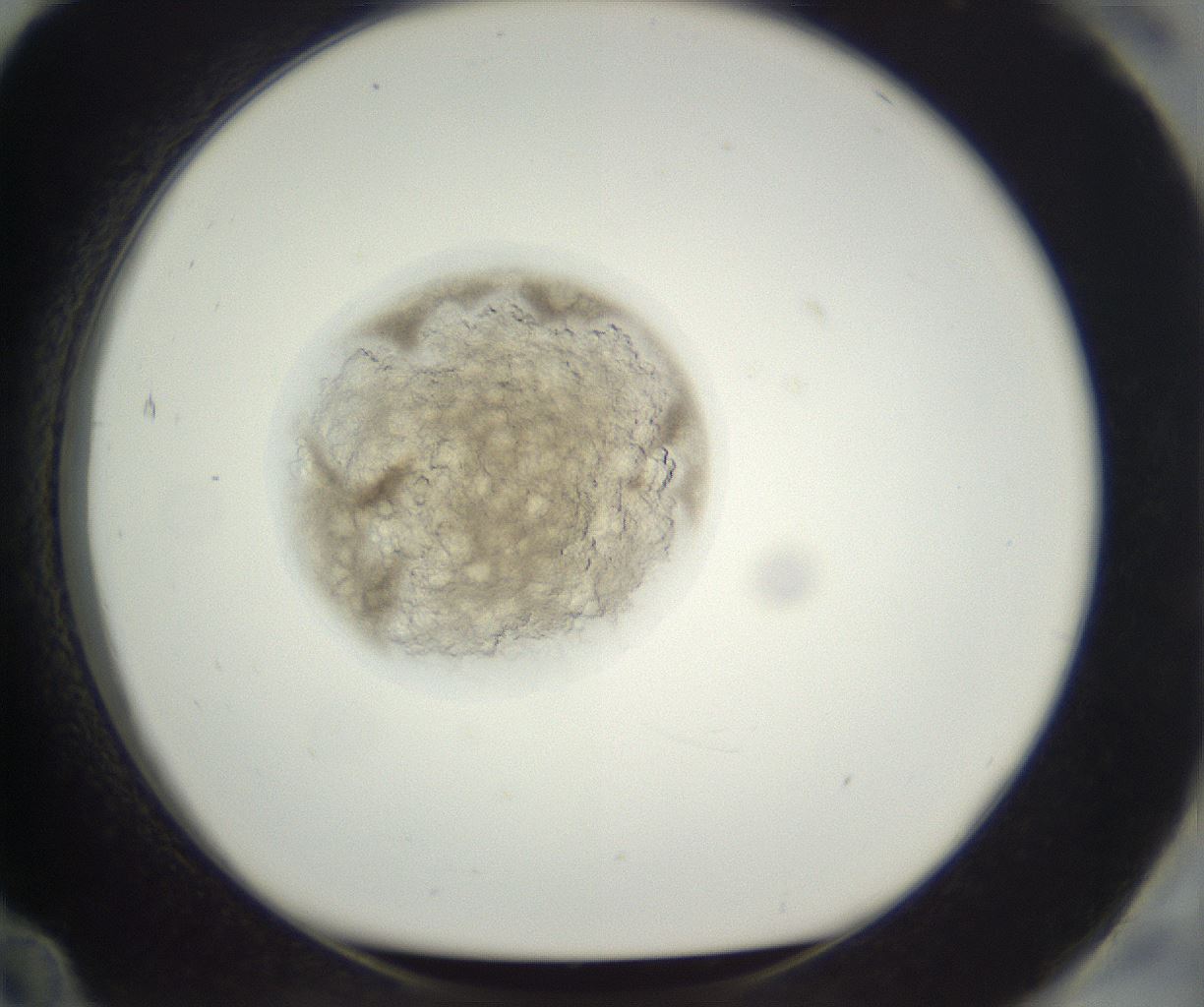 folderID398_plateID3398_batchID20682_wellNum84_profileID1_d1_r301766_ef.jpg