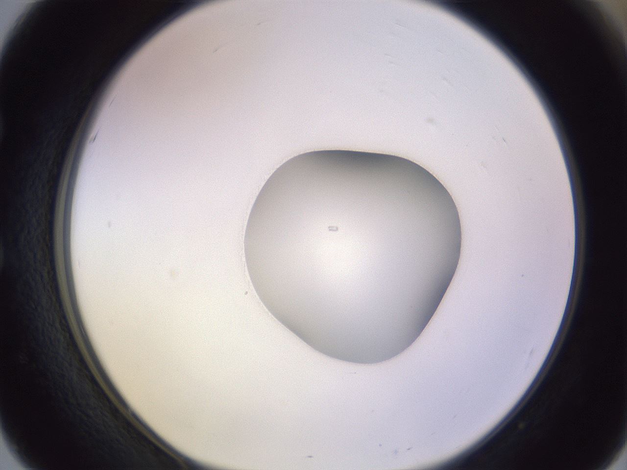 folderID421_plateID1421_batchID5175_wellNum51_profileID1_d1_r87332_ef.jpg
