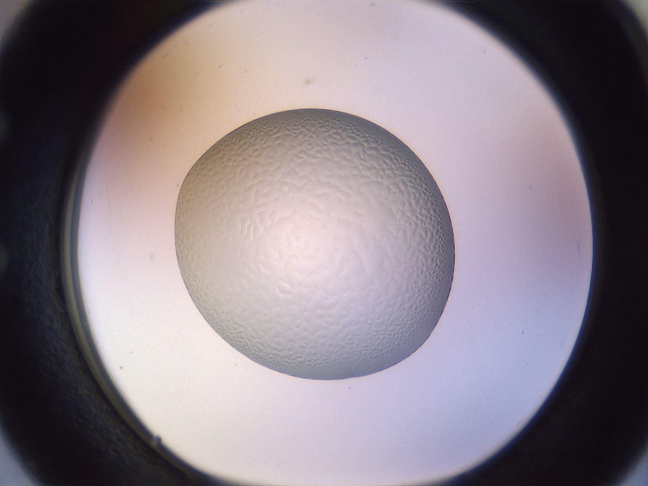 folderID451_plateID1451_batchID5446_wellNum50_profileID1_d1_r91853_ef.jpg