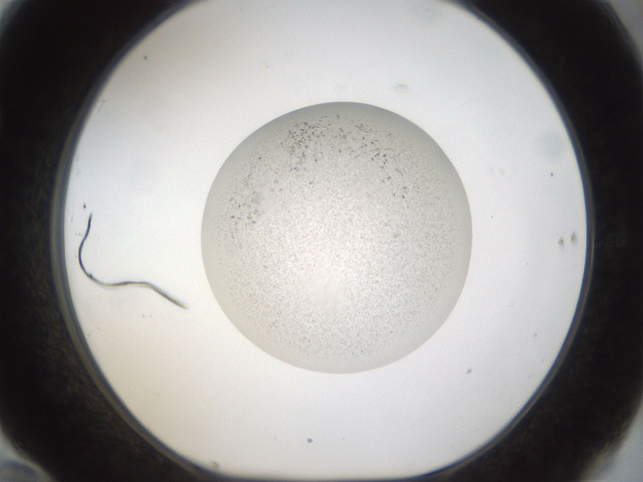 folderID49_plateID1049_batchID2390_wellNum70_profileID1_d1_r46989_ef.jpg