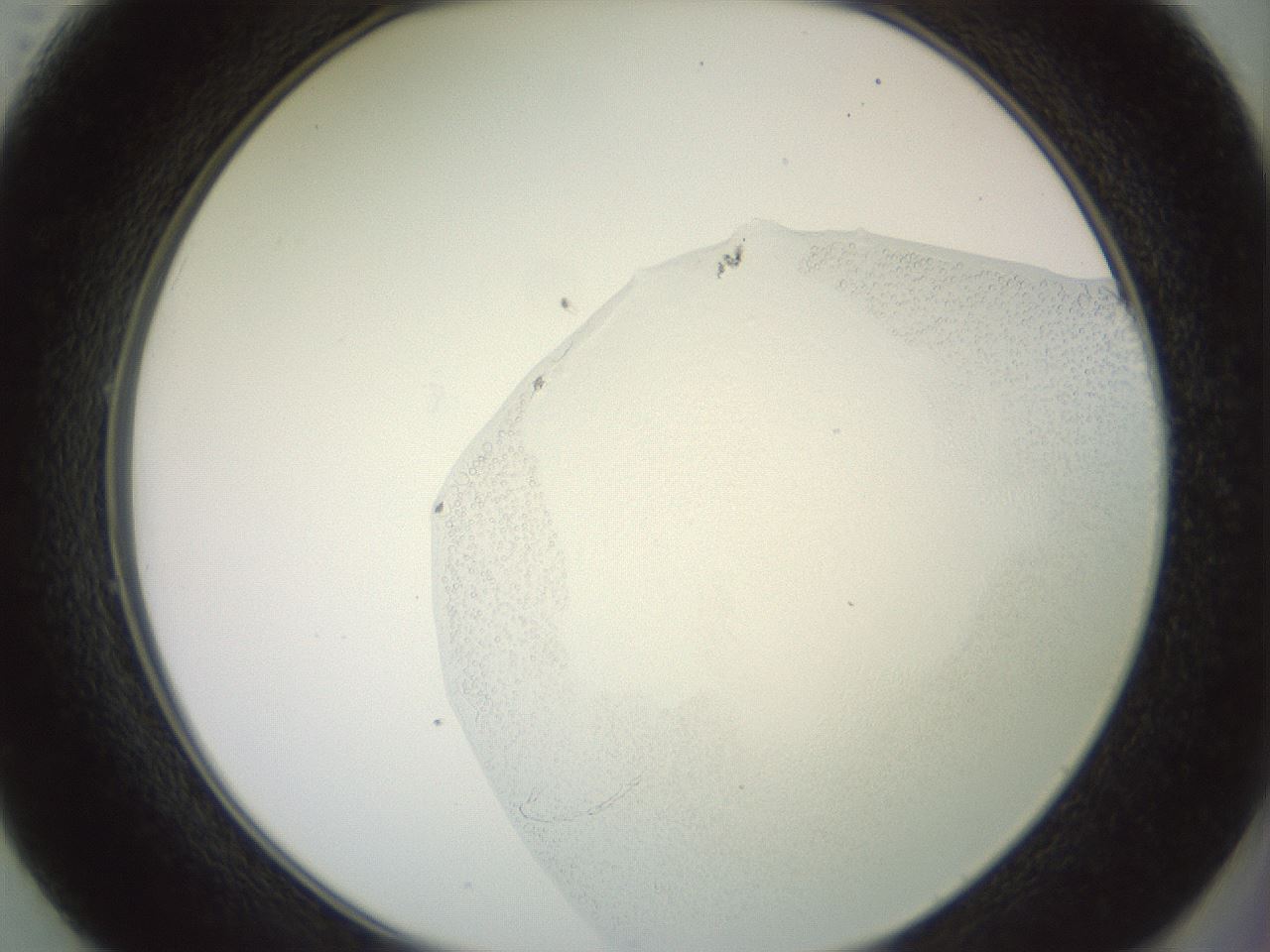 folderID500_plateID3500_batchID20666_wellNum49_profileID1_d2_r313255_ef.jpg