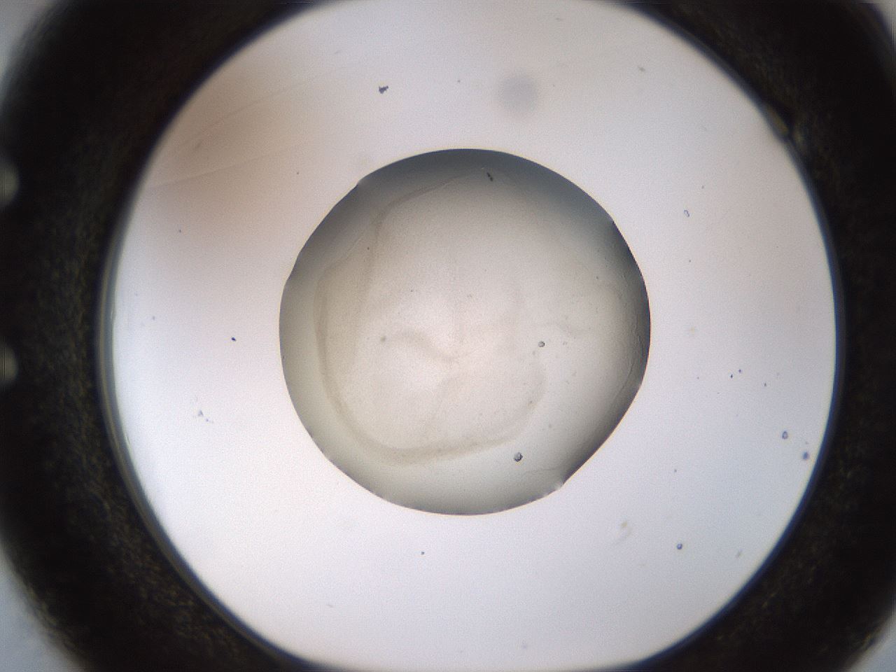 folderID501_plateID1501_batchID5842_wellNum49_profileID1_d1_r95393_ef.jpg