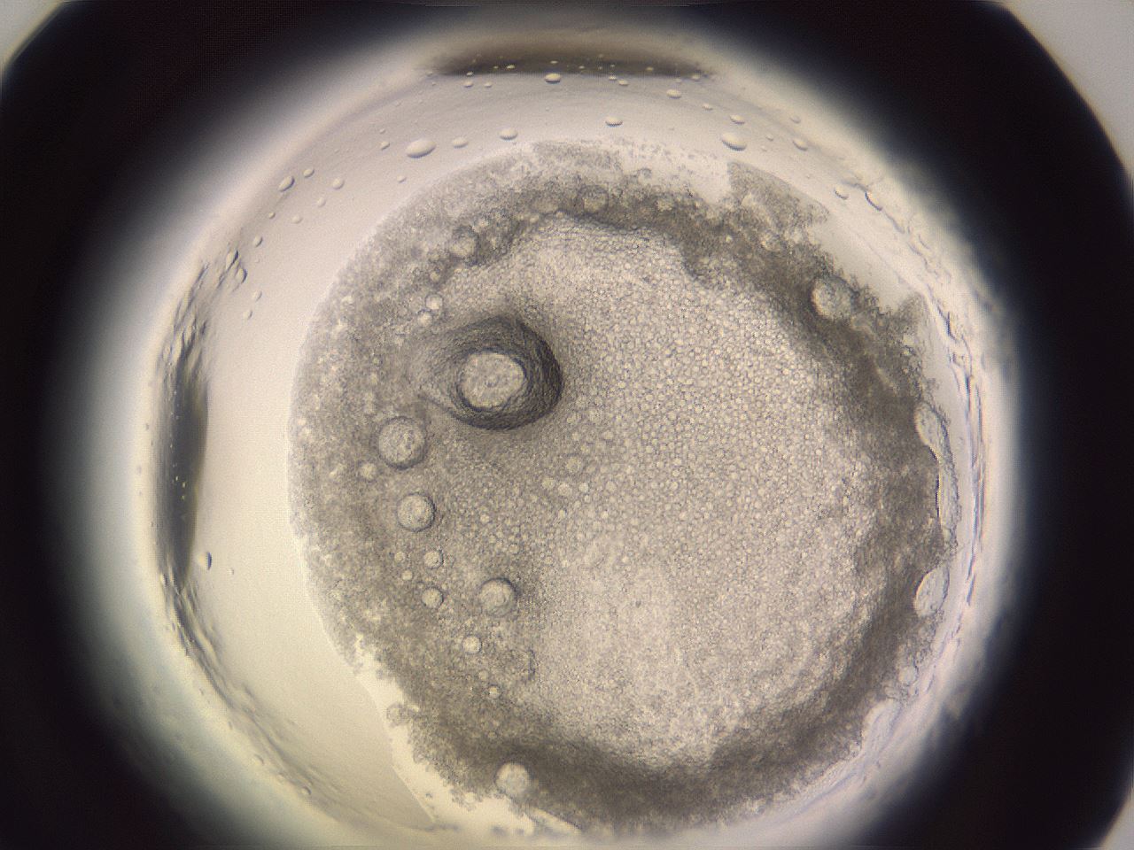 folderID599_plateID2599_batchID12956_wellNum71_profileID1_d1_r198363_ef.jpg
