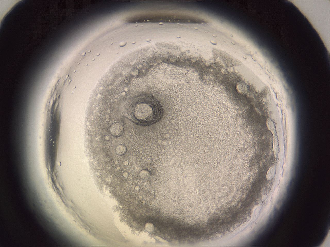folderID599_plateID2599_batchID13060_wellNum71_profileID1_d1_r198363_ef.jpg