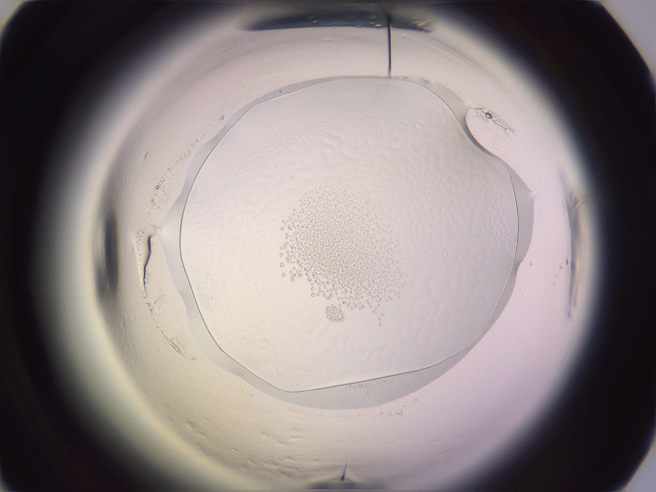 folderID603_plateID2603_batchID15102_wellNum62_profileID1_d1_r201504_ef.jpg