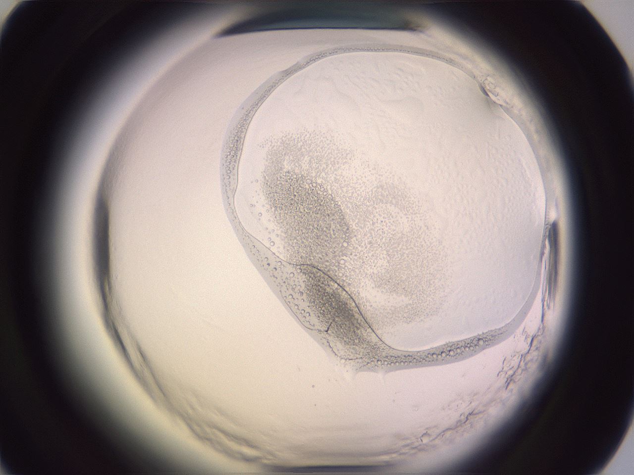 folderID605_plateID2605_batchID15107_wellNum61_profileID1_d1_r202942_ef.jpg