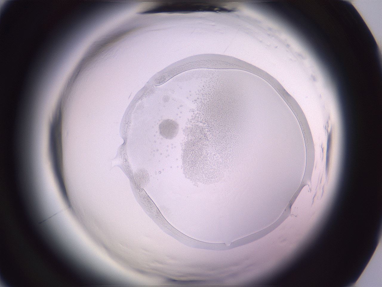 folderID606_plateID2606_batchID12756_wellNum1_profileID1_d1_r203626_ef.jpg