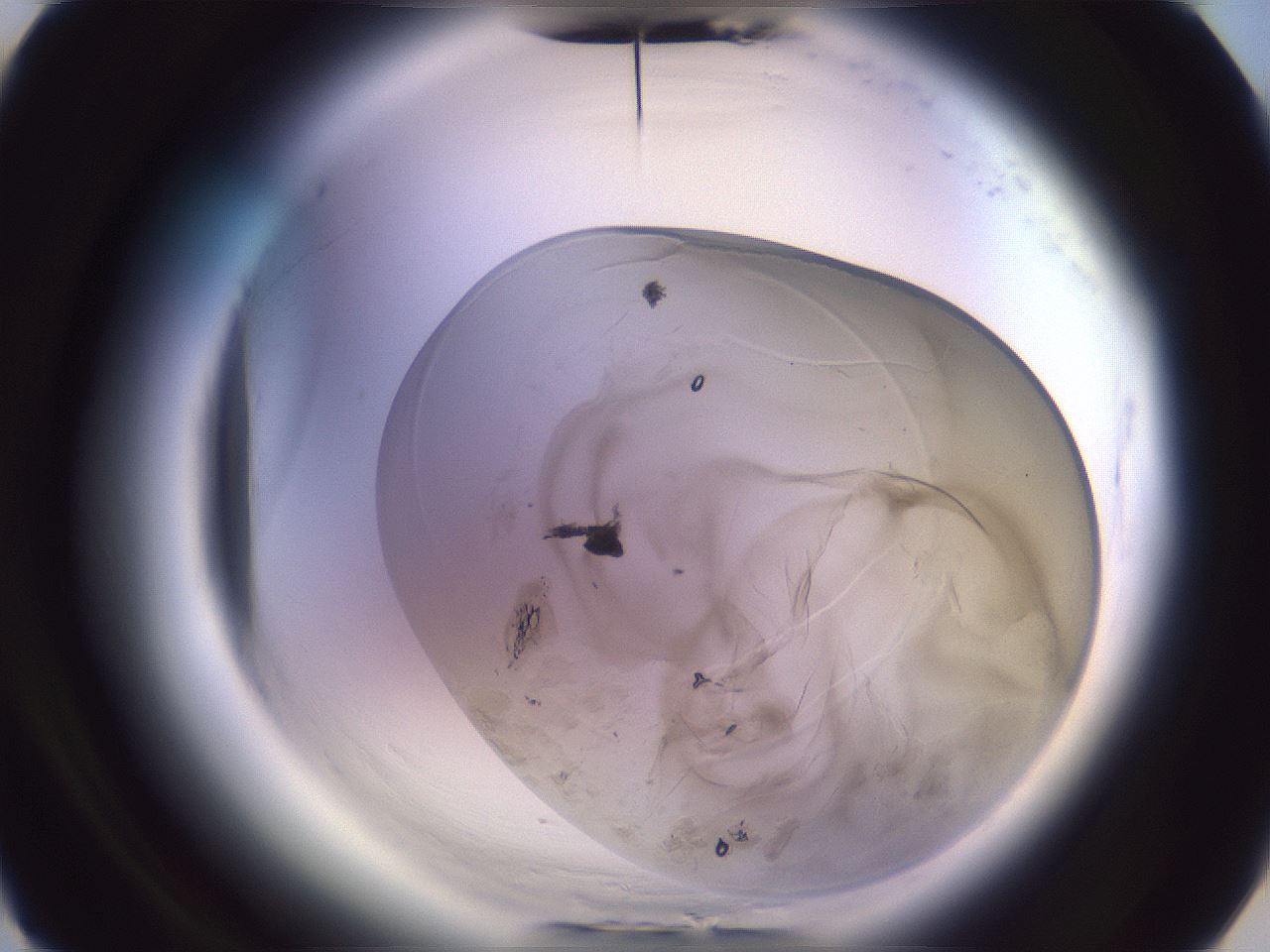 folderID607_plateID2607_batchID12759_wellNum14_profileID1_d3_r204531_ef.jpg