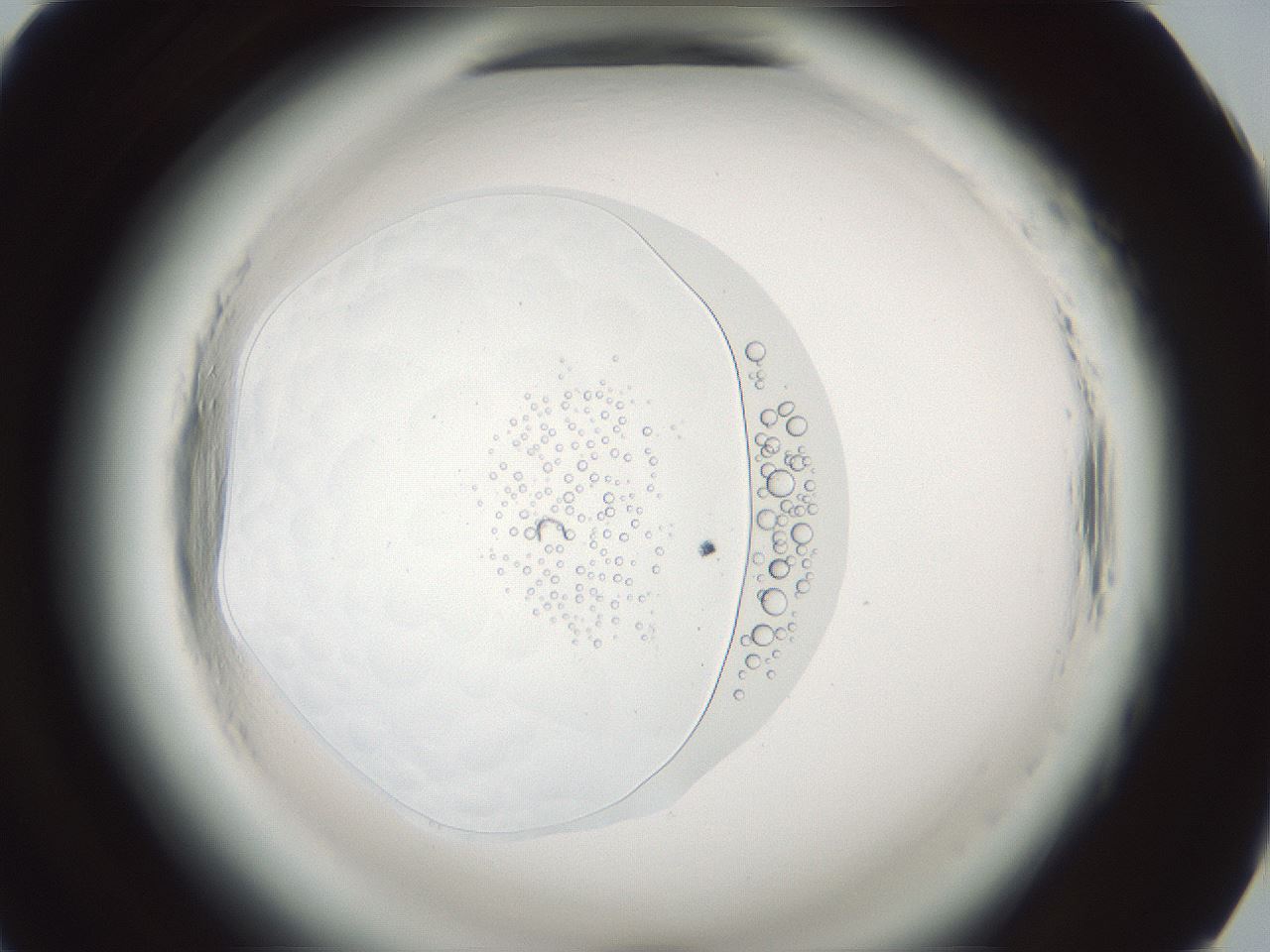 folderID610_plateID2610_batchID15121_wellNum57_profileID1_d1_r206674_ef.jpg