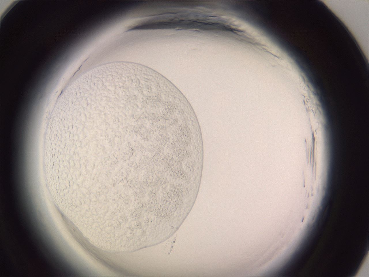 folderID640_plateID2640_batchID13201_wellNum93_profileID1_d1_r214755_ef.jpg