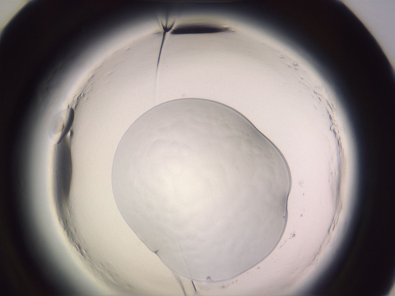 folderID640_plateID2640_batchID14561_wellNum72_profileID1_d2_r214693_ef.jpg