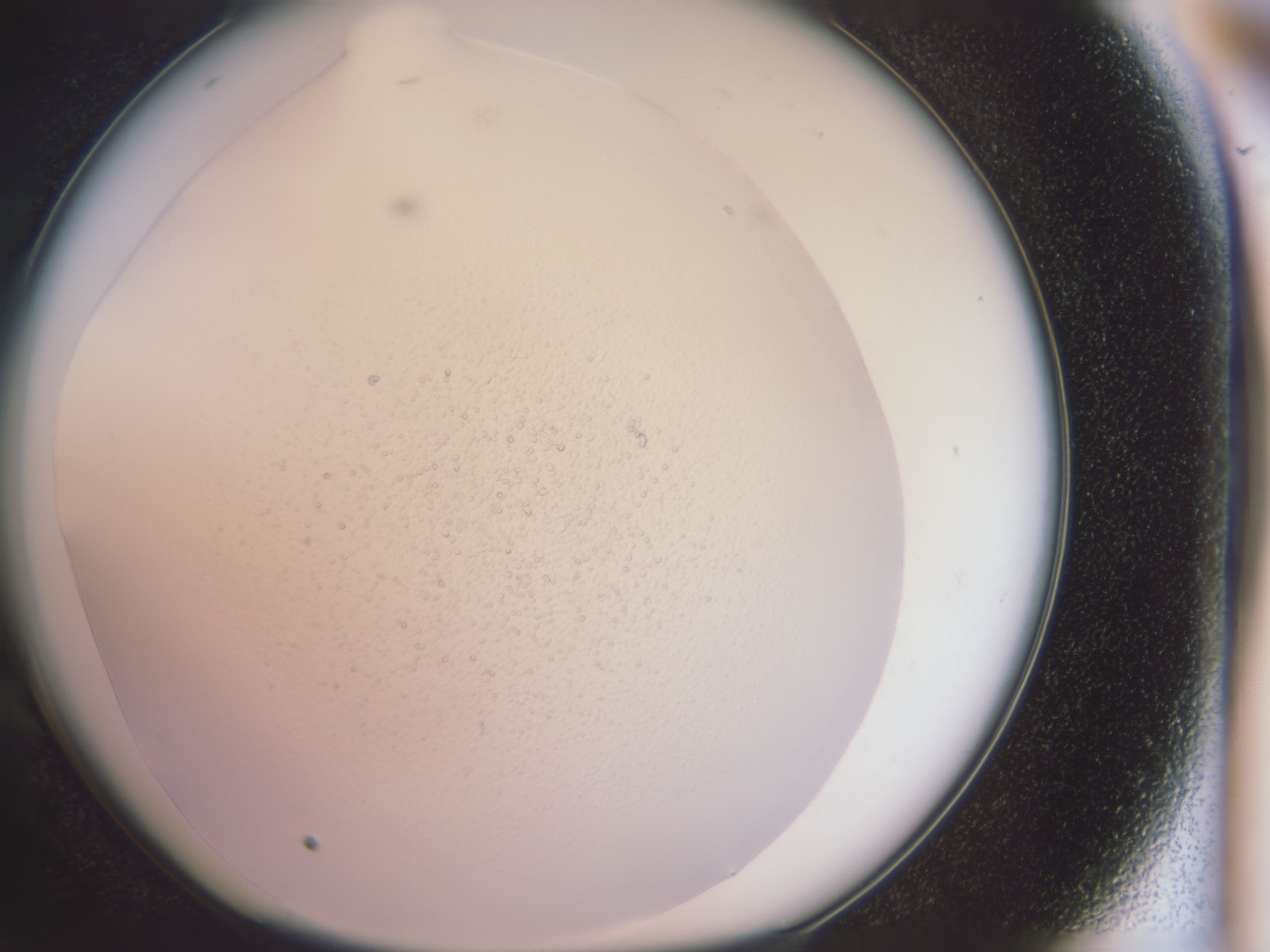 folderID690_plateID690_batchID668_wellNum58_profileID1_d1_r17276_ef.jpg