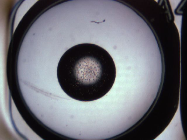 folderID825_plateID825_batchID4956_wellNum4_profileID1_d1_r24172_ef.jpg
