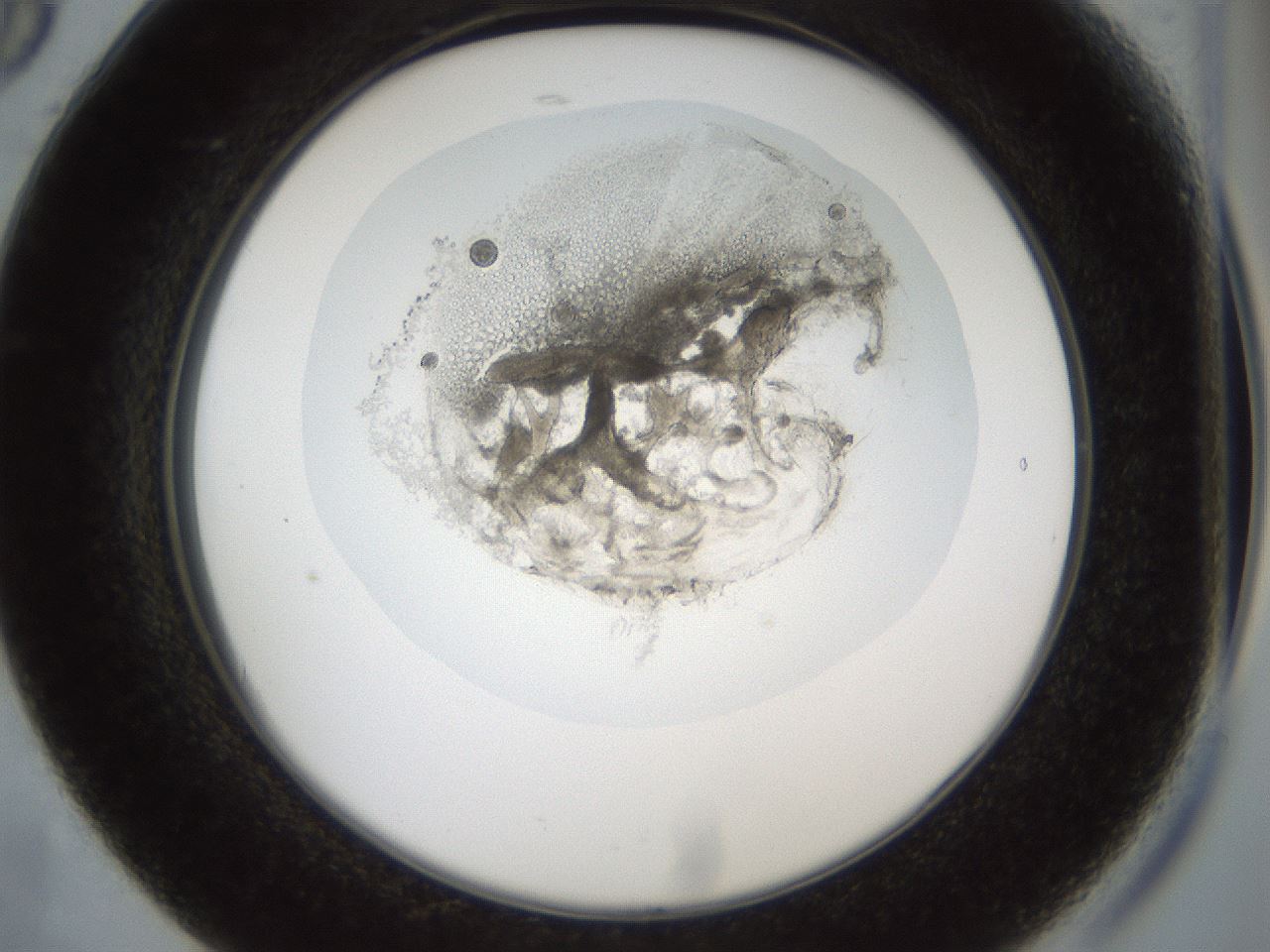 folderID857_plateID857_batchID1004_wellNum17_profileID1_d2_r30768_ef.jpg