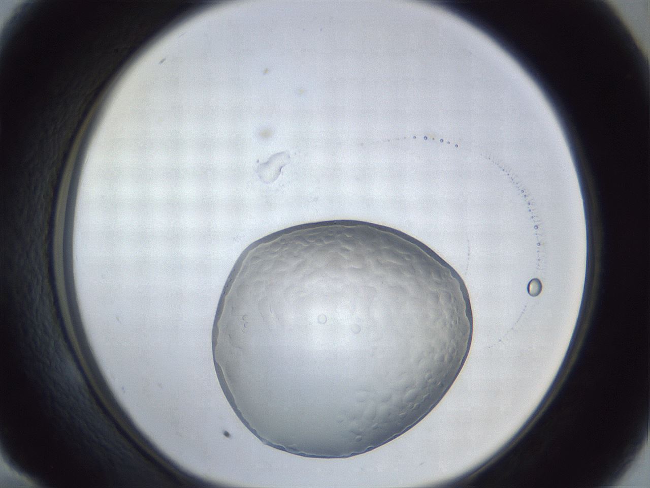 folderID925_plateID925_batchID1265_wellNum58_profileID1_d1_r33597_ef.jpg