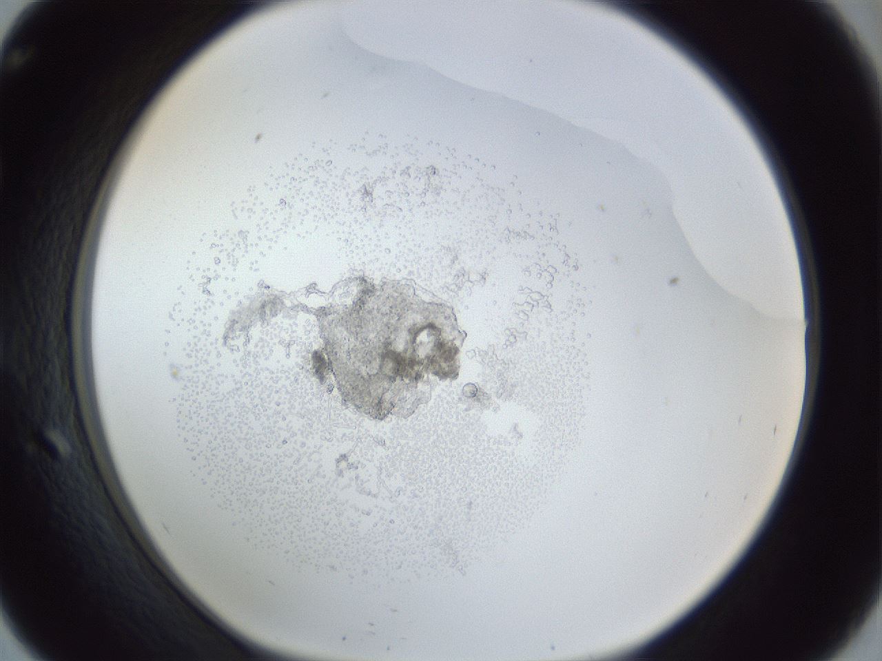 folderID944_plateID944_batchID1308_wellNum57_profileID1_d1_r35675_ef.jpg