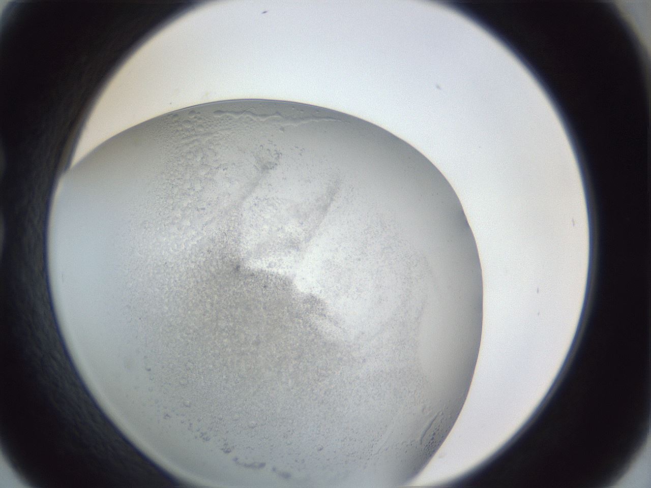 folderID966_plateID966_batchID1340_wellNum30_profileID1_d1_r37691_ef.jpg