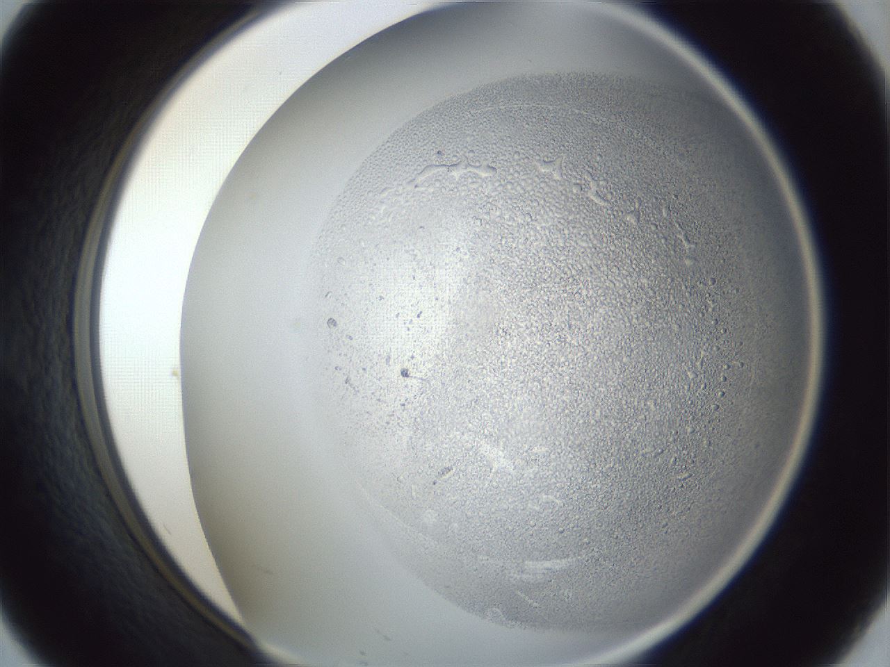 folderID966_plateID966_batchID1465_wellNum57_profileID1_d1_r37718_ef.jpg